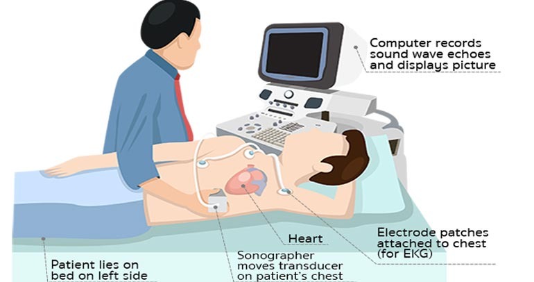 Echo Cardiogram Treatment In Coimbatore