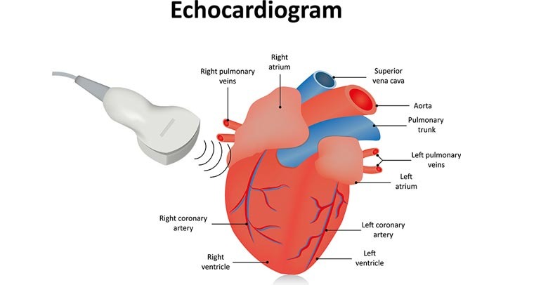 Echo Cardiogram Test In Coimbatore
