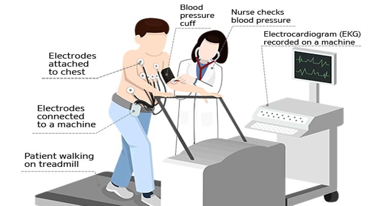 Treadmill Test In Coimbatore