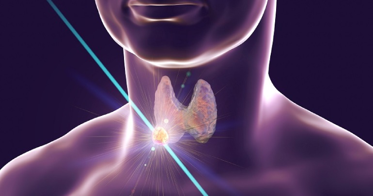 Thyroid Surgery Hospital In Coimbatore